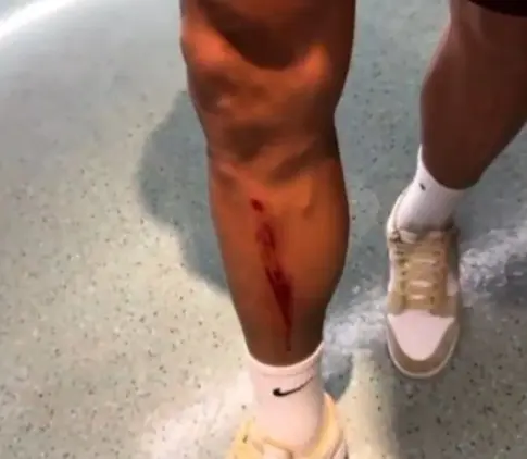 Corte na perna de Serna: lance com omissão da falta pelo árbitro, confira a imagem